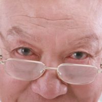 Коприва невен и шипка при жълтеница