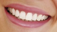 бели зъби
