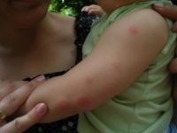 Комарите са най-активни по залез-слънце