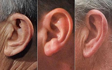 Ушите говорят за болестите ни