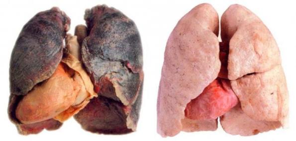 Бял дроб на пушач и на непушач
