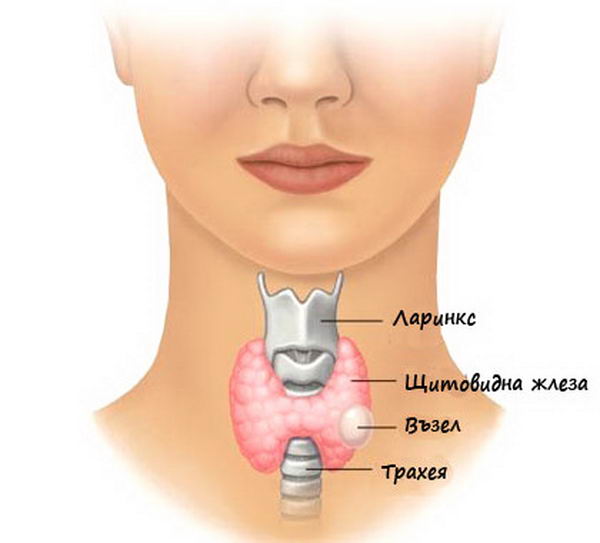 възли на щитовидната жлеза