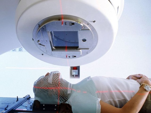 лъчетерапия кожа