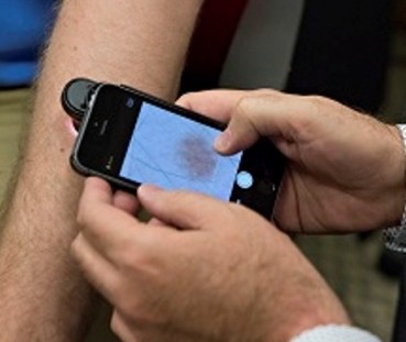 iPhone открива рак на кожата за по-малко от минута