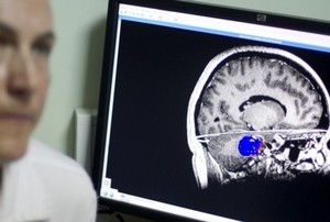 Мазнините се превръщат в средство срещу рак на мозъка