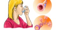 astma prichini