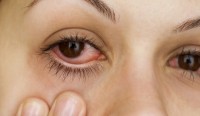 Очната алергия може да засегне всеки