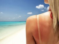 Слънчевото изгаряне може да предизвика рак на кожата