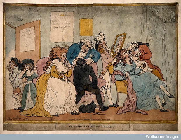 На зъболекар през 18-ти век