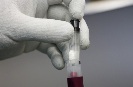 blood-test for cancer