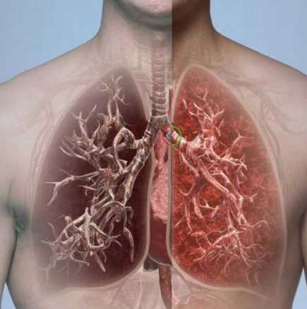 Подобрете състоянието на дихателната си система
