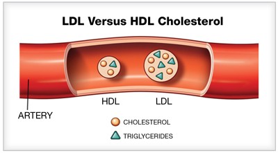 LDL и HDL