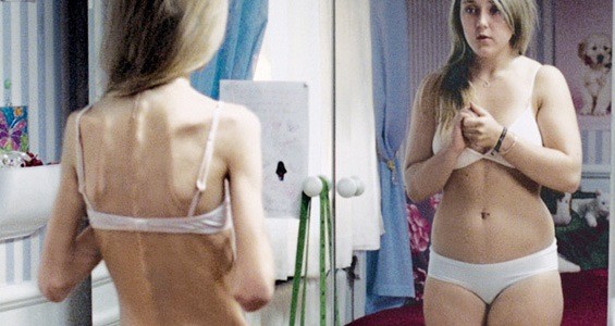Анорексията предизвиква нереален образ в огледалото