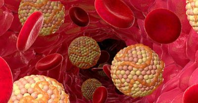 общ холестерол