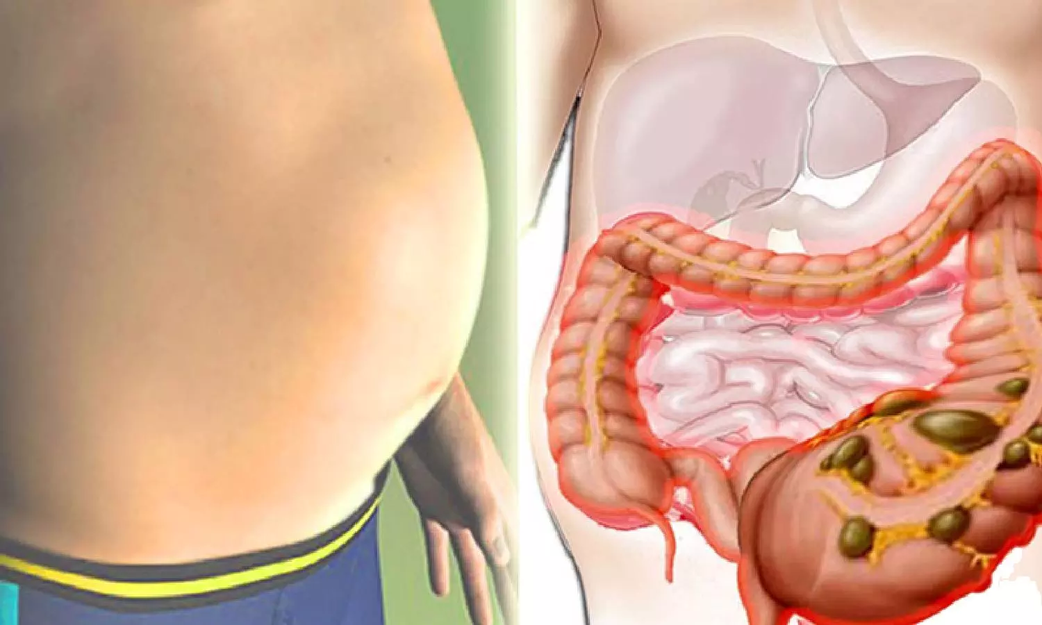 подуване на корема