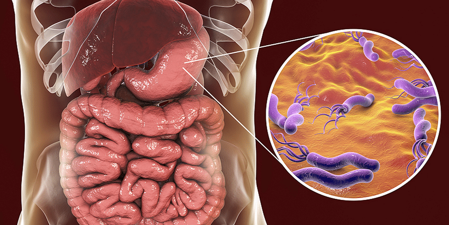 Злонамерена бактерия Helicobacter pylori (допълнена)