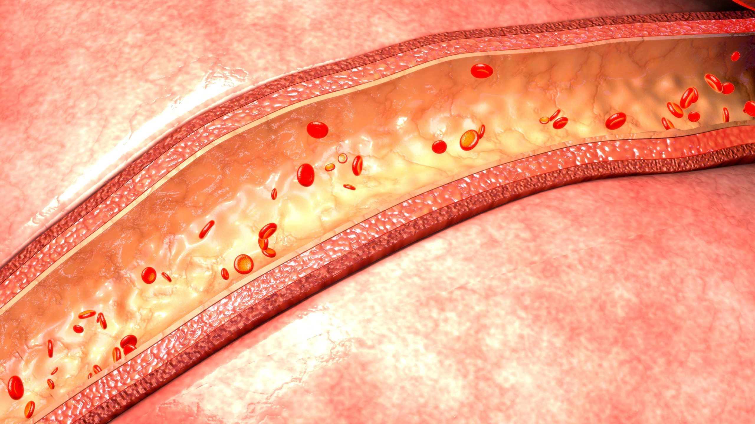 видове васкулит