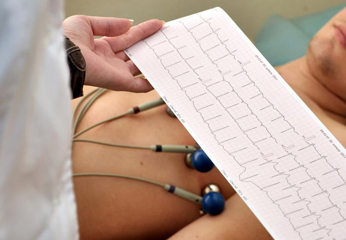 електрокардиограма