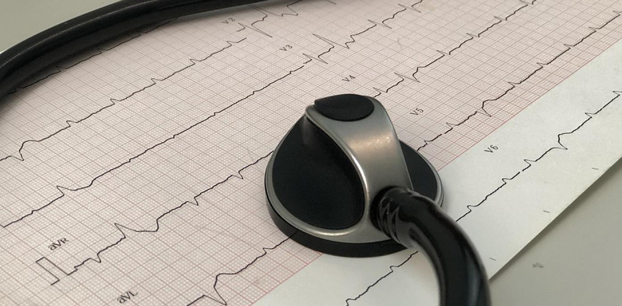 изследвания на сърцето