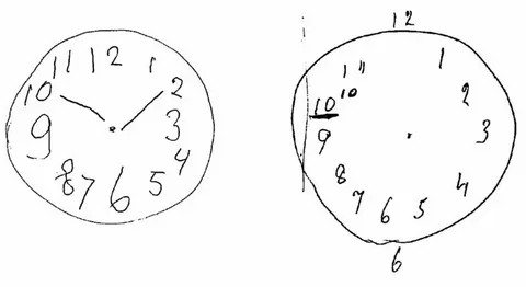 тест за деменция с часовник
