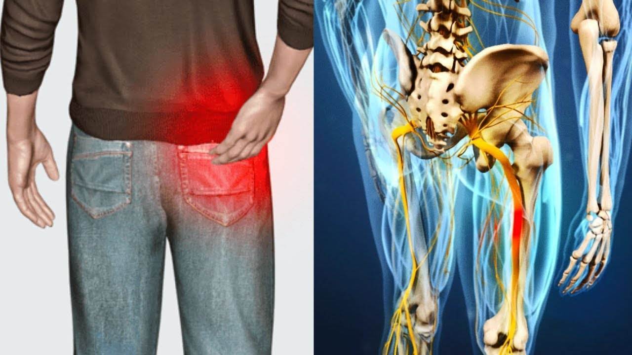 Бабини рецепти при възпален нерв, мехлем за възпален нерв причини