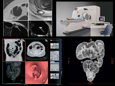 компютърна томография