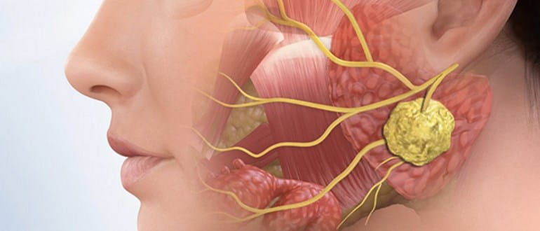 Бабини рецепти при възпален нерв, мехлем за възпален нерв възпаление лицев нерв