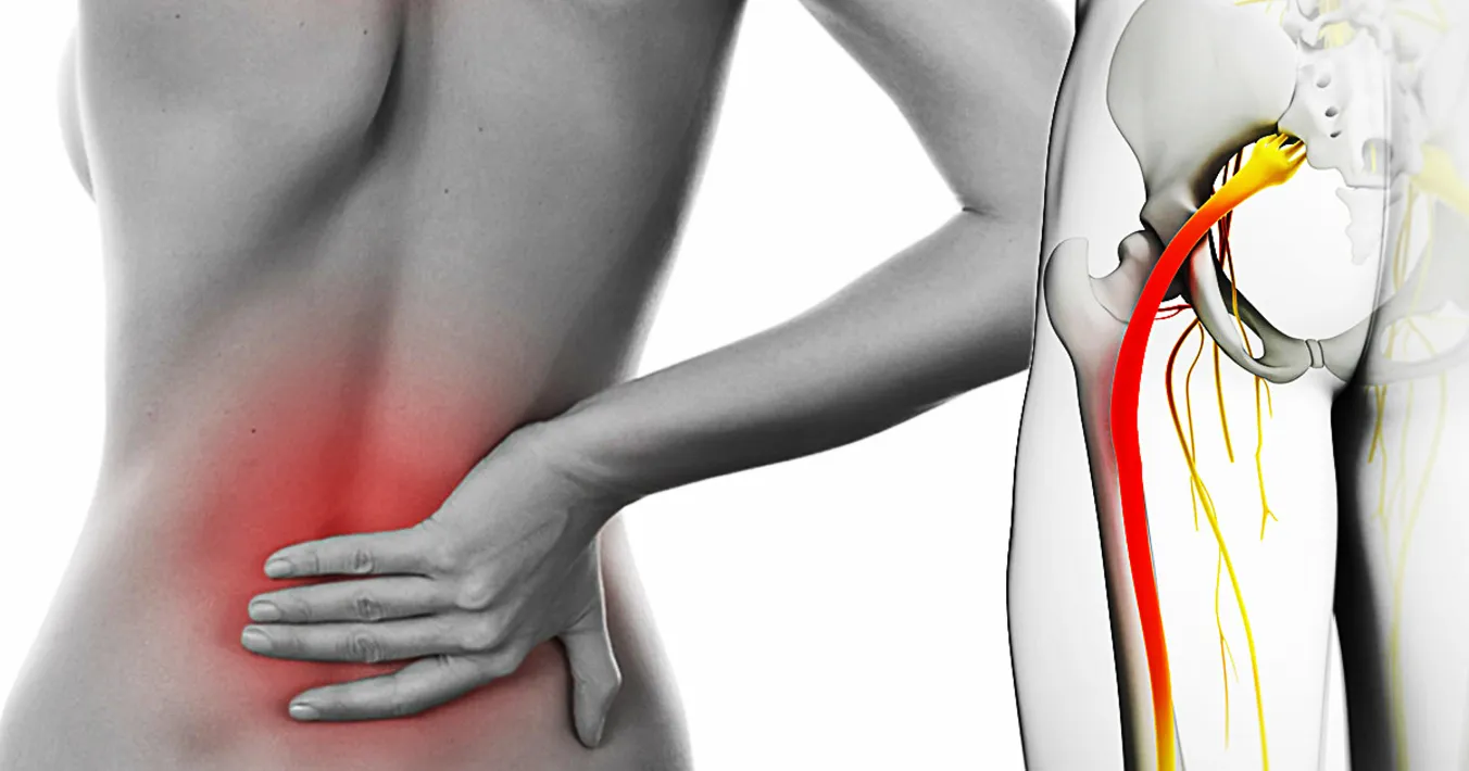 Бабини рецепти при възпален нерв, мехлем за възпален нерв прищипан нерв