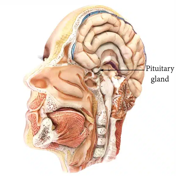 Аденом на хипофизата симптоми и лечение аденом на хипофизата