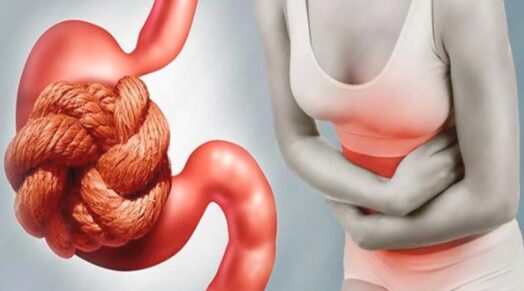 мезентериална тромбоза