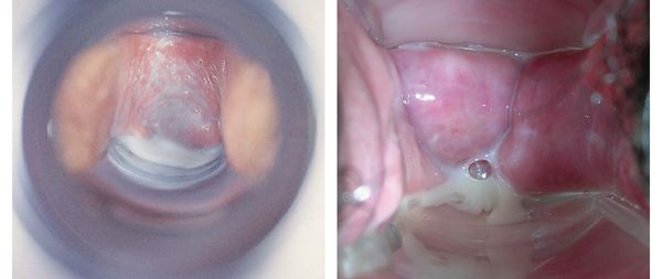 сърбеж и неприятна миризма 