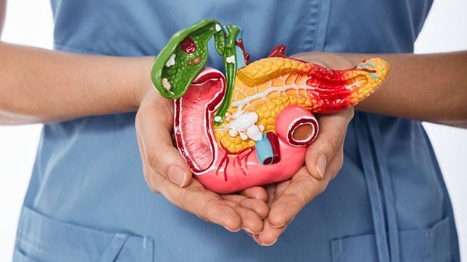  рак на панкреаса