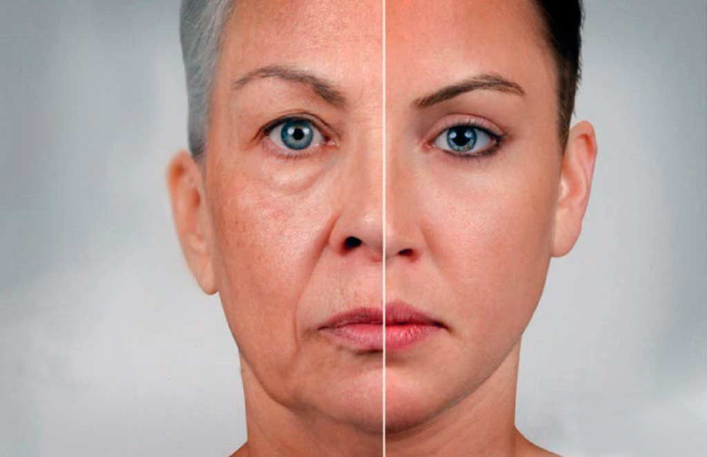 птоза на клепача