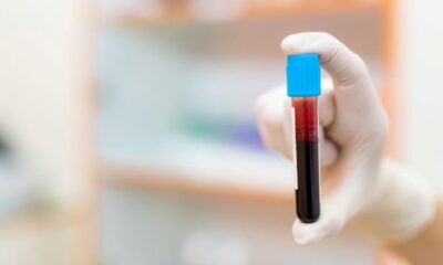 бели кръвни телца